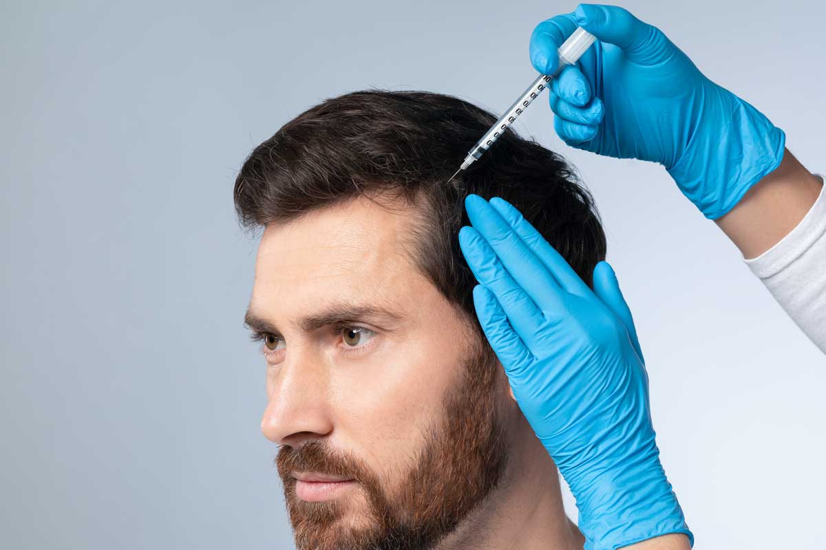 PRP Hair Restoration